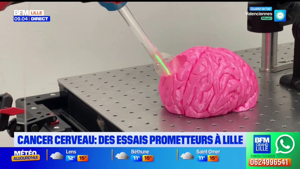 Un essai clinique pour combattre le glioblastome, le cancer du cerveau le plus sévère, a commencé au CHU de Lille. La start-up, Hemerion, vient de remporter un trophée.