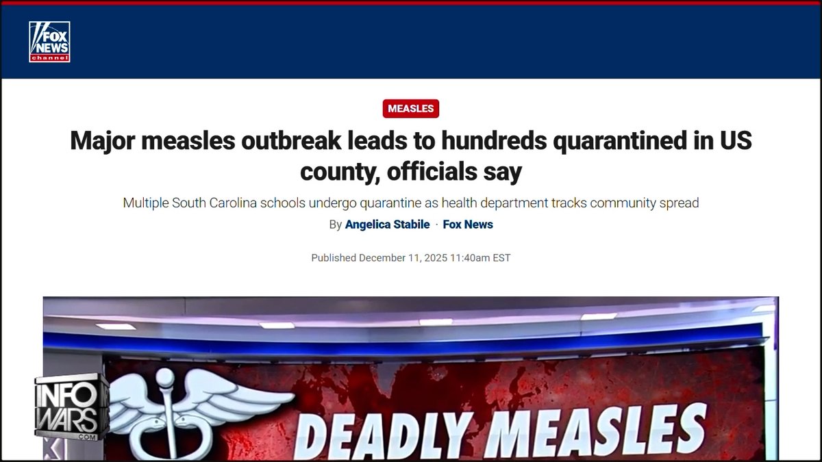BREAKING ANALYSIS: Latest US Measles Cases Hyped By The Mainstream Media As "Accelerated Outbreak" Dr. Andrew Wakefield Responds To This Fearmongering & Gives Short History Of The Measles Vaccine