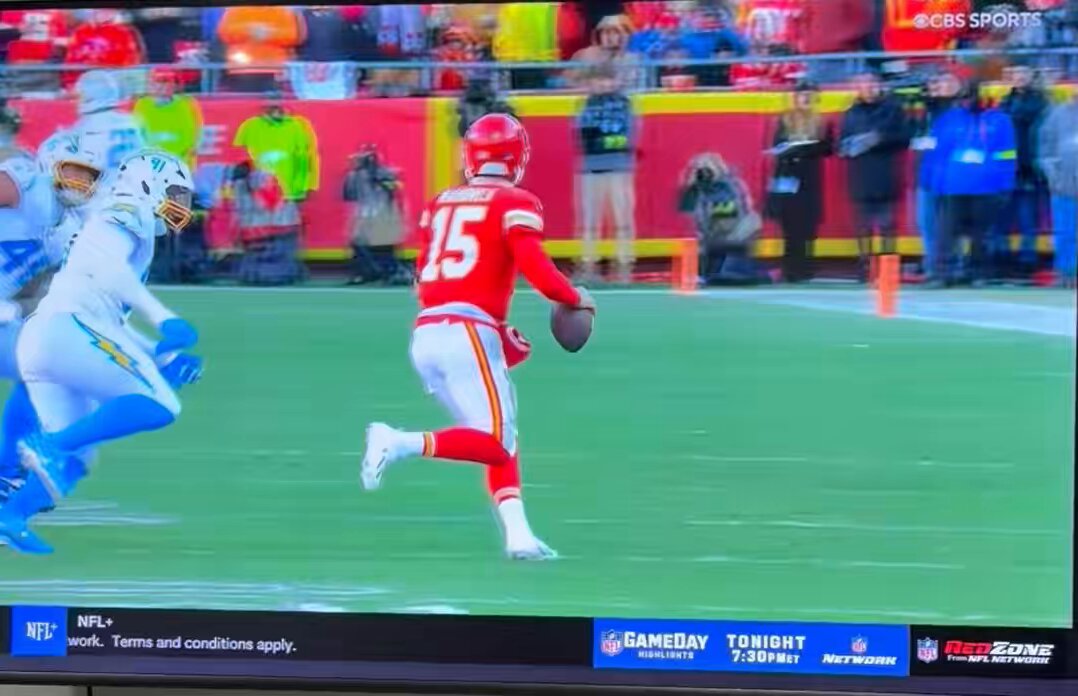 Patrick Mahomes #chiefs Left knee hyperextendeds while slightly laterally rotated. I’m hoping it wasn’t enough excursion for an ACL or PCL but those will be assessed for. LCL and posterolateral corner are also concerns. Hoping he avoided anything major