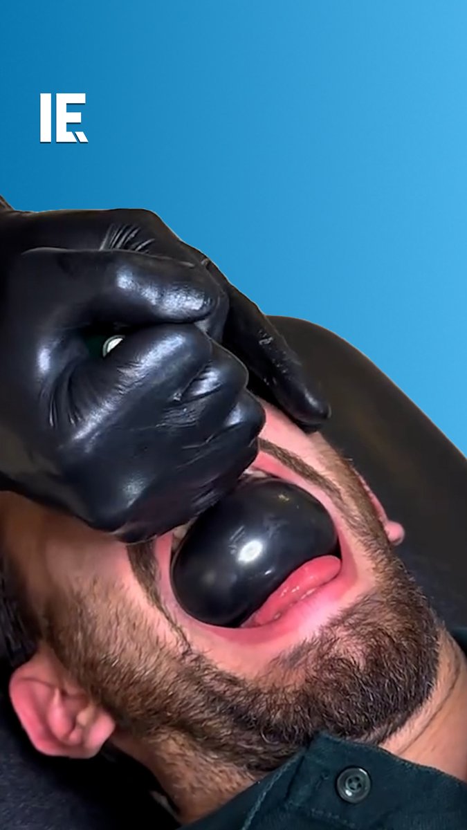 Would you ever consider trying balloon therapy as a medical treatment? 🎥 chiropractor_znj / IG
