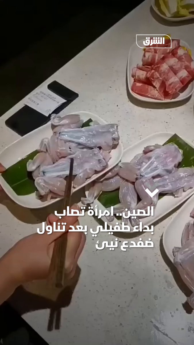 في حالة هي الأولى من نوعها.. وجبة من "ضفدع نيئ" تنتهي بدودة طفيلية في رئة امرأة صينية