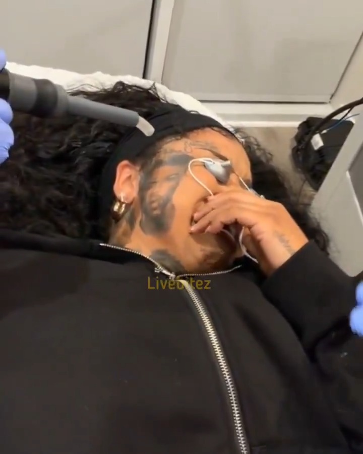 Chrisean Rock has started the painful process of removing her Blueface tattaoo. On Tuesday (Dec. 16), Chrisean went on Instagram Live to document the laser tattoo removal. In the video, she yelled out in pain and cried, but ensured the women doing the procedure that she was OK. “Jesus!” she cried out. “It burns.” She also posted a message about her emotional attachment to the tatt. “Removing the tattoo from my face was a huge accomplishment for me," she wrote in her IG Story. "I didn’t realize how emotionally attached I was to it until today. Letting it go released so much trauma I’ve been carrying. It feels like I closed a chapter and chose healing. 💌🕊️✝️ thank you YAHWEH.” Chrisean got the massive fave ink in 2024. At one point, she had over seven tattoos of Blue on her body in the form of his face or name. She has since covered up others as well.