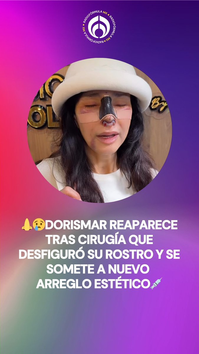 👃😢Dorismar reaparece tras cirugía que desfiguró su rostro y se somete a nuevo arreglo estético. 💉La conductora de Televisa fue víctima de una mala práctica de un cirujano plástico que le hizo tres operaciones en la nariz, las cuales terminaron dañando su tabique.💔 Aquí toda la info: