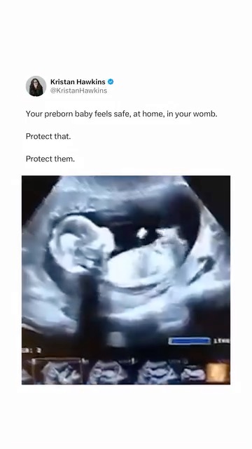 The womb should be the safest place on earth for preborn babies. That’s why we fight. We will end abortion in our lifetime. #ProLifeGeneration