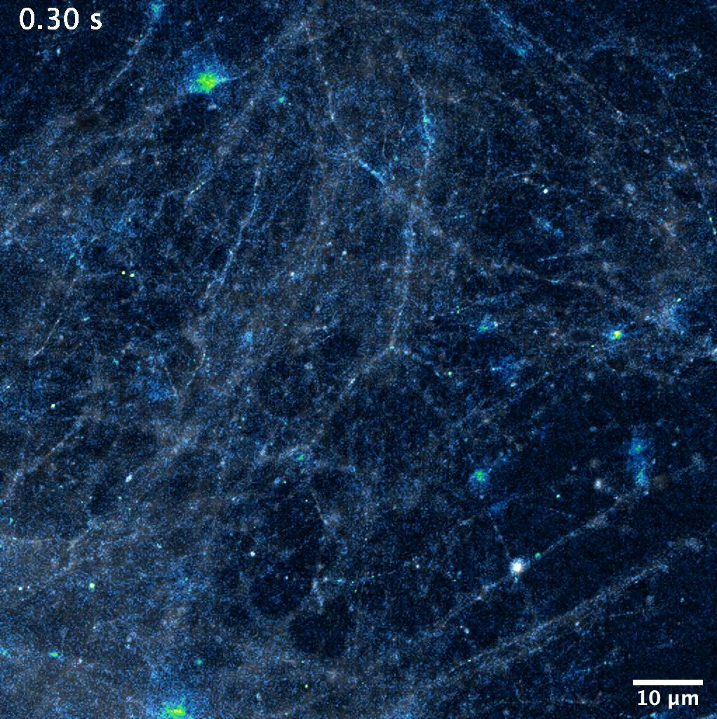 The fireworks in your mind. 🧠✨ This sparkling video shows the neurotransmitter glutamate being released into synapses, made possible by an indicator developed by Abhi Aggarwal, MD, Kaspar Podgorski, and team. #HappyNewYear #NYE