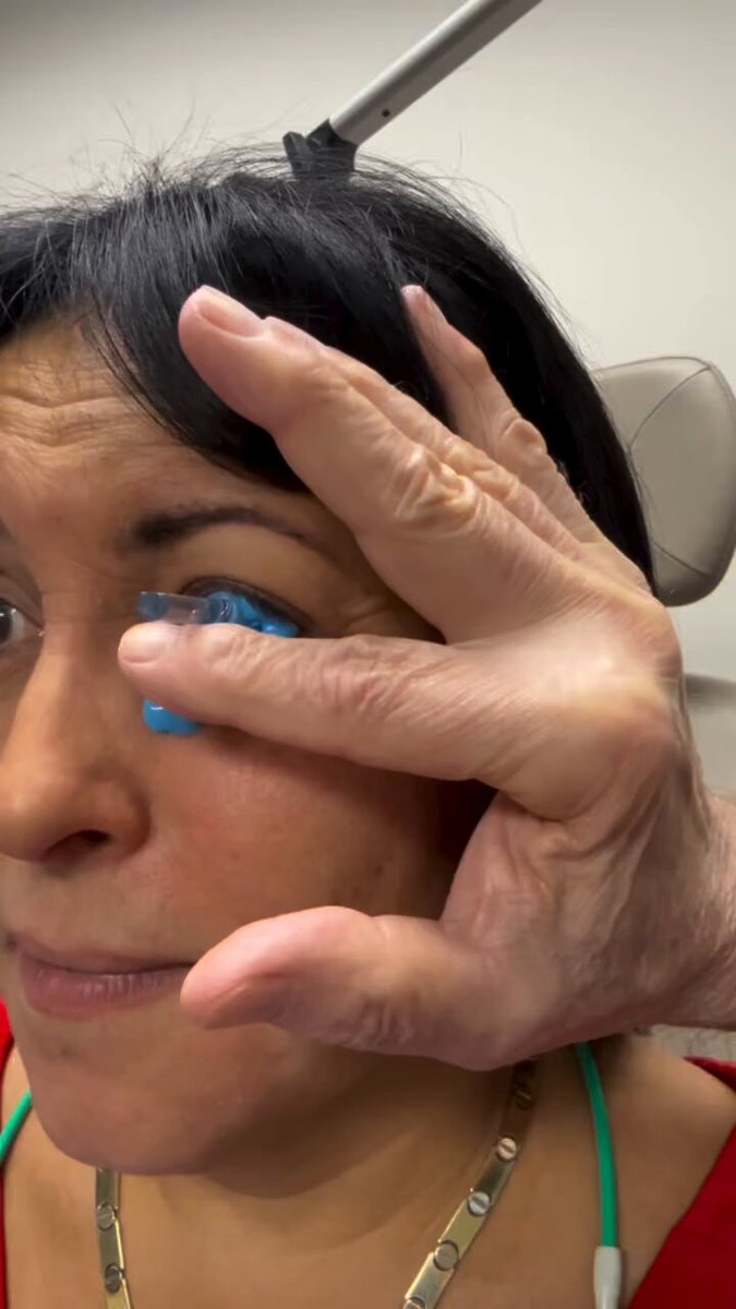 "Just get LASIK, whats the worst that can happen?"