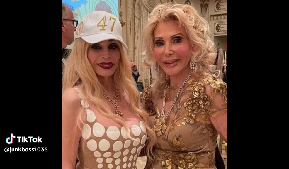 Imagine spending $250,000 dollars for the Maralago face! What would you do with that much money and do you think they looked better before or after? 👇👇👇👇