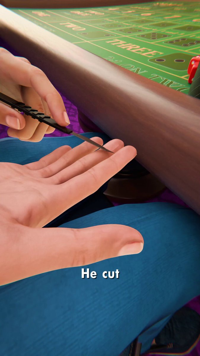 He Stitched A Magnet In His Finger 😳