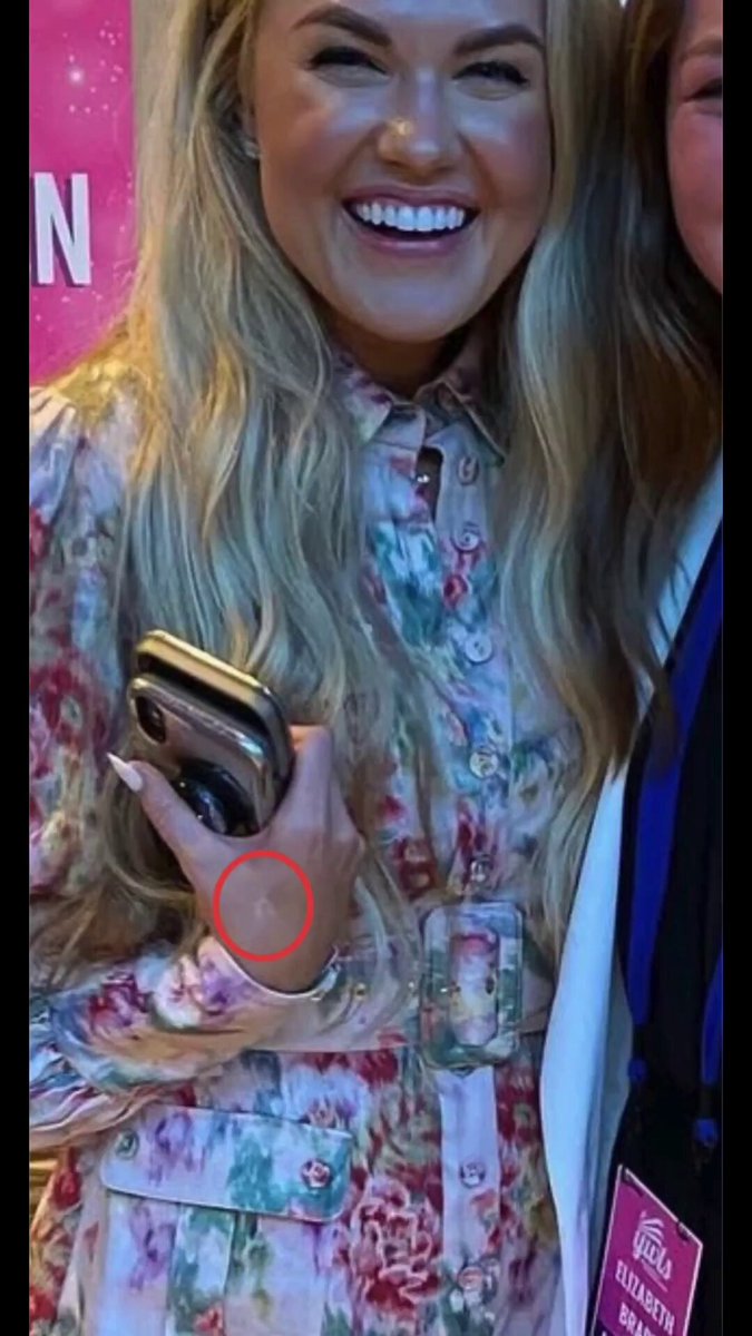 🚨 PEOPLE ARE NOTICING THE BRANDING MARKS ON ERIKA KIRK’S HANDS - AND CONNECTING THE DOTS Across multiple photos, videos, and public appearances, the same symbols can be seen on the hands of Erika Kirk - same placement, same shapes, repeatedly visible over time, yet never acknowledged or explained. That’s not random. And it’s not decorative. Symbols like this are typically used to signal meaning or affiliation to people who know what they’re looking at, while everyone else is expected to ignore it and move on. What are the marks, what do they represent - and why has nobody ever addressed them? 📷- Kelly