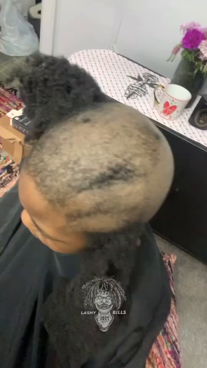 I got a bald spot…🧑🏾‍🦲