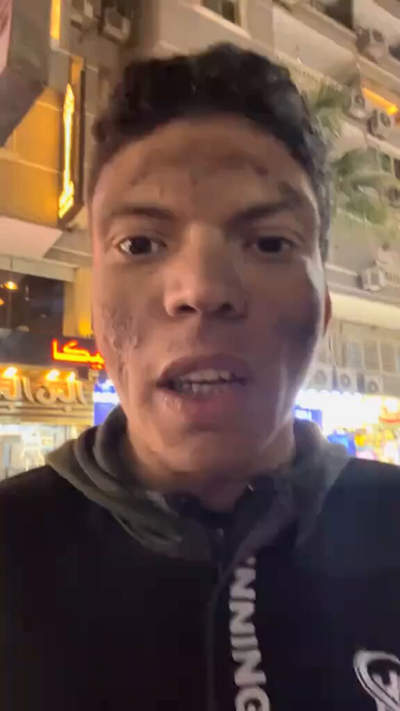 لا حول ولا قوة الا بالله العلي العظيم ربنا يحنن عليك القلوب يارب ويشفيك ويعافيك ويرزقك ويوسع رزقك يارب 🥺💔يعني دة يعمل ايه ياعالم علشان يعيش ذنبه ايه انه مريض شاب عاوز يشتغل مفيش رحمة 💔💔💔💔💔💔💔