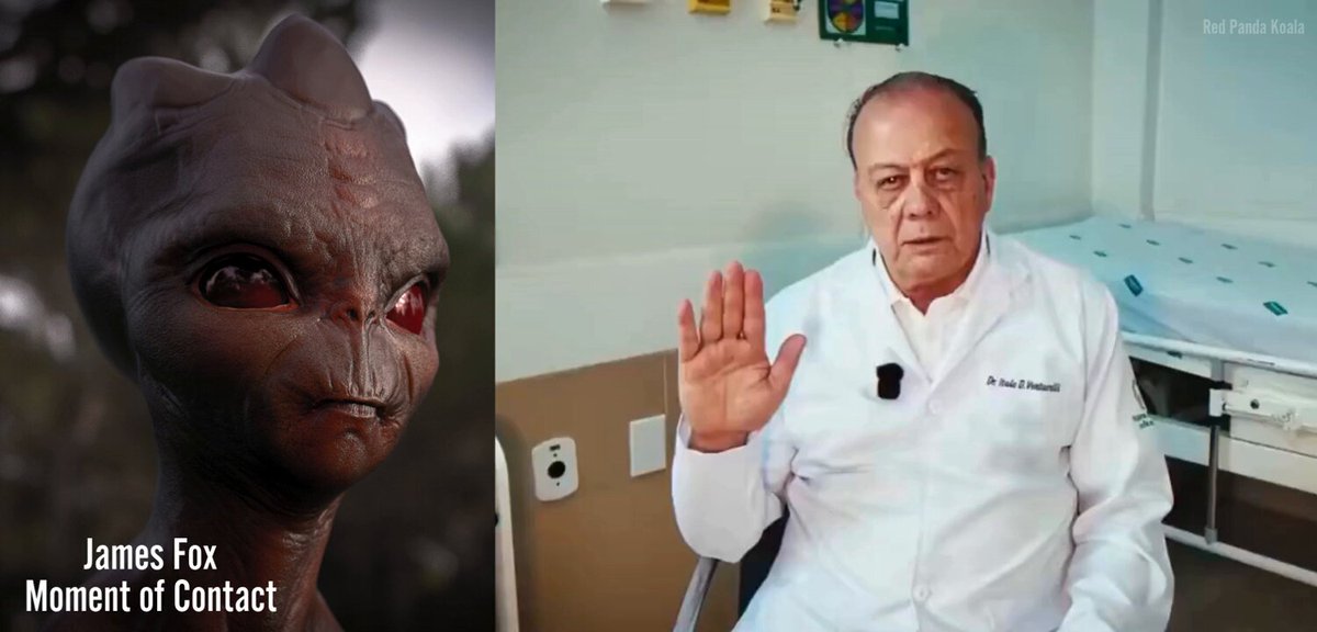 🚨 Brazilian Doctor breaks silence on 1996 Varginha UFO crash and alien incedent Dr. Italo Venturelli, a neurosurgeon affiliated with Hospital Regional do Sul de Minas in Varginha, Brazil has been identified as a medical witness connected to the 1996 Varginha incident According to investigative filmmaker James Fox, Dr. Venturelli reported observing a non-human entity while it was on a hospital bed following the event