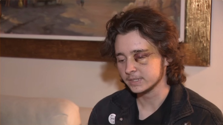 21-year-old activist blinded by ICE: "It was completely unnecessary. I'm 5'1. I weigh 102 pounds. It's completely unnecessary to shoot me point blank in the face, in my eye, only a few feet away from me. I think he was trying to kill me. I fully believe he was trying to kill me."