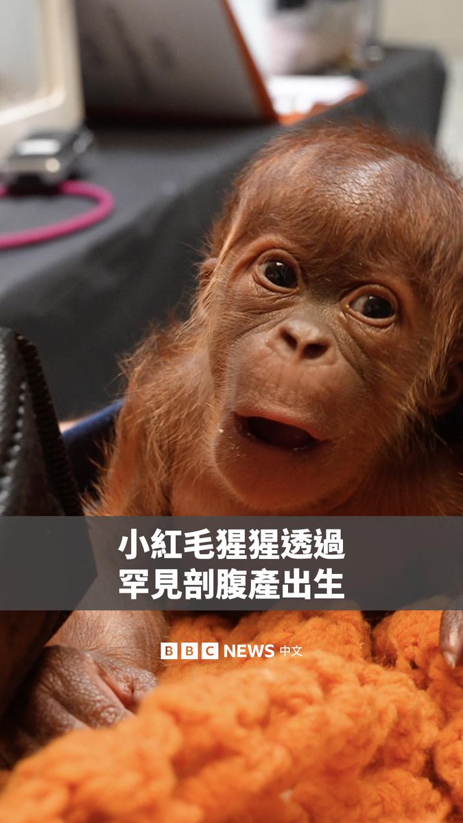 一只红毛小猩猩在美国孟菲斯动物园通过一次罕见的剖腹产手术顺利出生，并在母亲术后恢复后与她重新团聚。