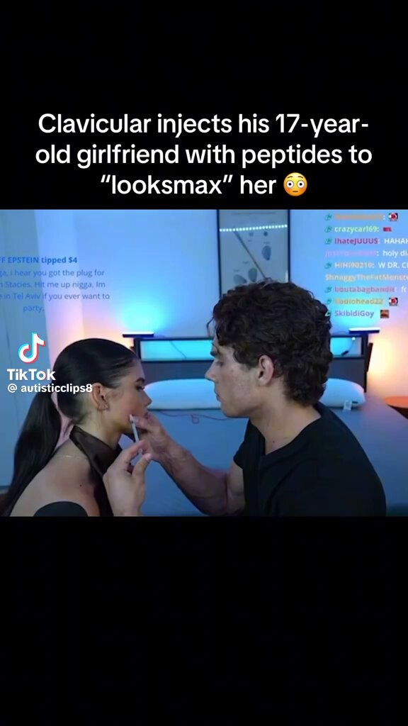 This is some kind of mental illness. Injecting a 17 year old girl to “looksmaxx” her is insane
