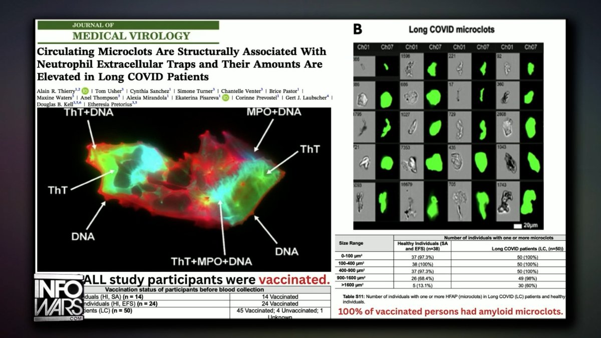 STUDY: "100% Of COVID-19 Vaccinated Individuals Have Circulating Microclots In Their Blood!" Del Bigtree & Alex Jones Respond To Breaking Research That Reveals How The Death Shot Pollutes The Blood With 'Misfolded Fibrin,' Often Mistakenly Classified As Long COVID