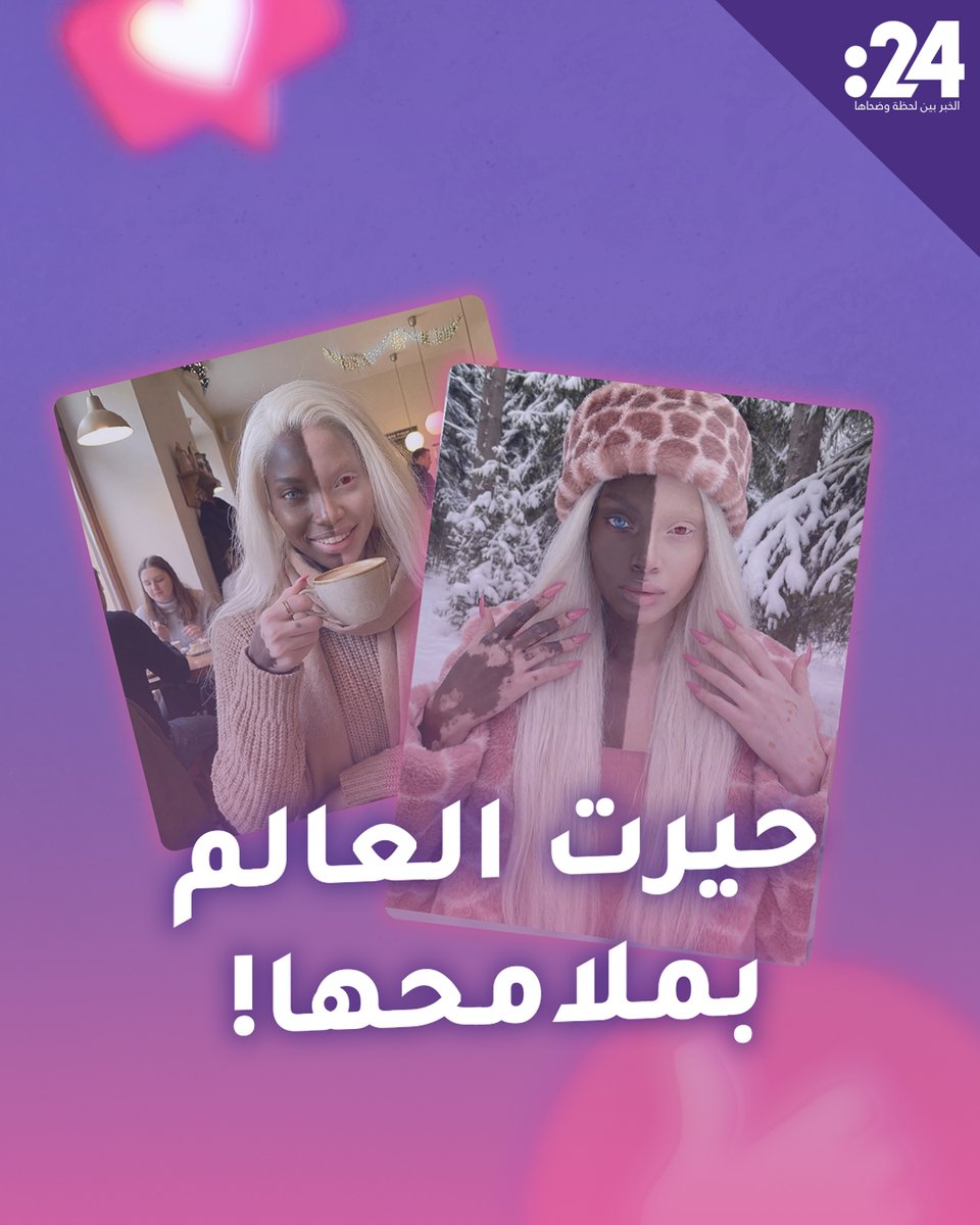 حيرت العالم بملامحها! الفتاة السمراء الشقراء.. هل هي حقيقية؟ ترندي