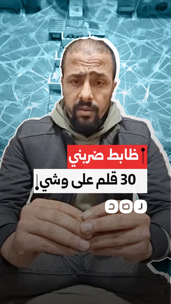 "ضربني 30 قلم على وشي" مواطن يستغيث بعد تعرضه للتعذيب والضرب على يد ضابط شرطة
