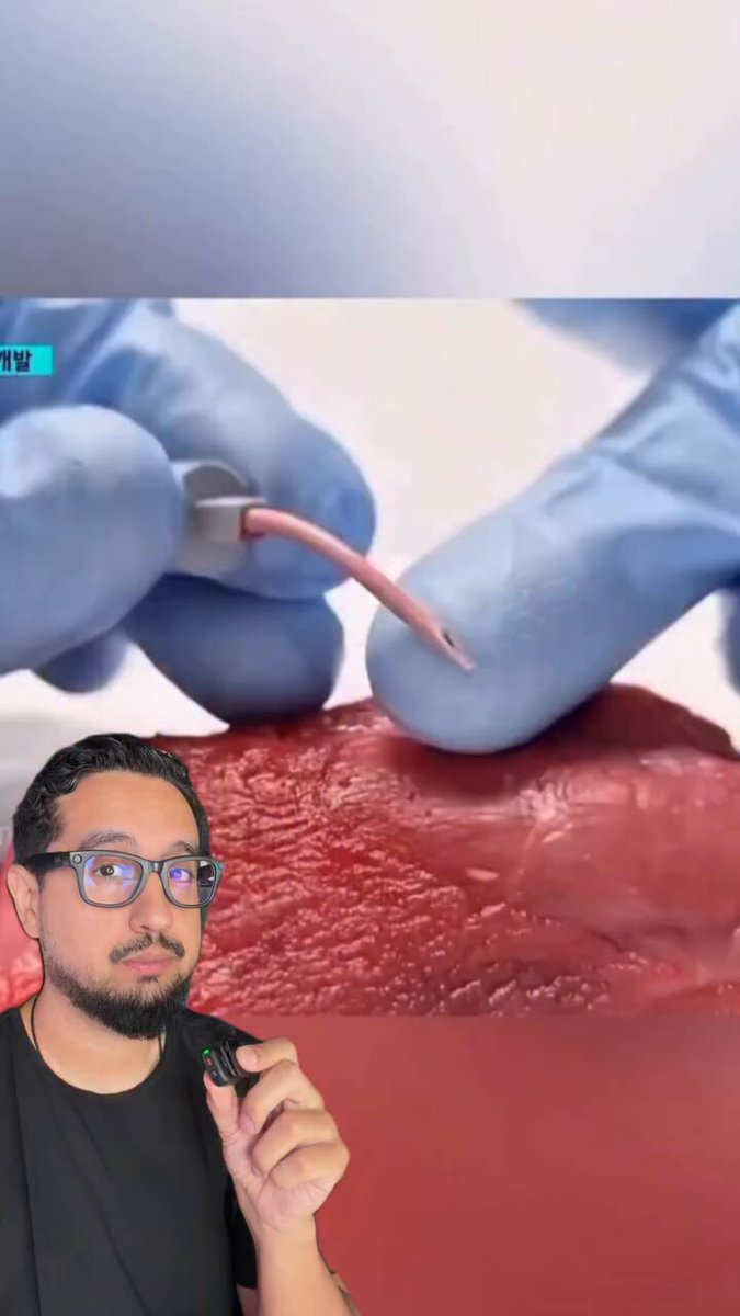 🚨VEJA: Cientistas da Coreia do Sul estão desenvolvendo uma agulha que entra dura e sai mole.