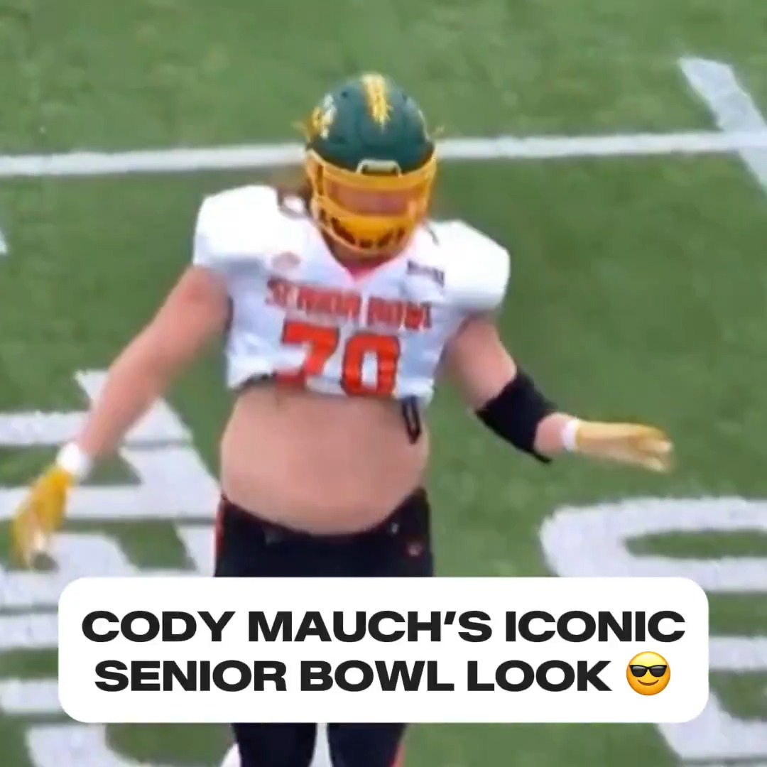 Long red hair, missing front teeth &amp; full belly out… Cody Mauch is an absolute legend for rocking this look 👏🤣
