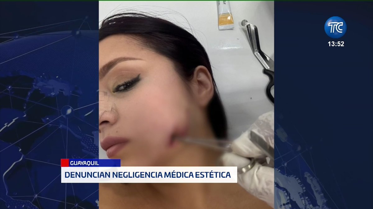 Una ciudadana denuncia negligencia médica por parte de un centro de estética en Guayaquil. Más detalles en