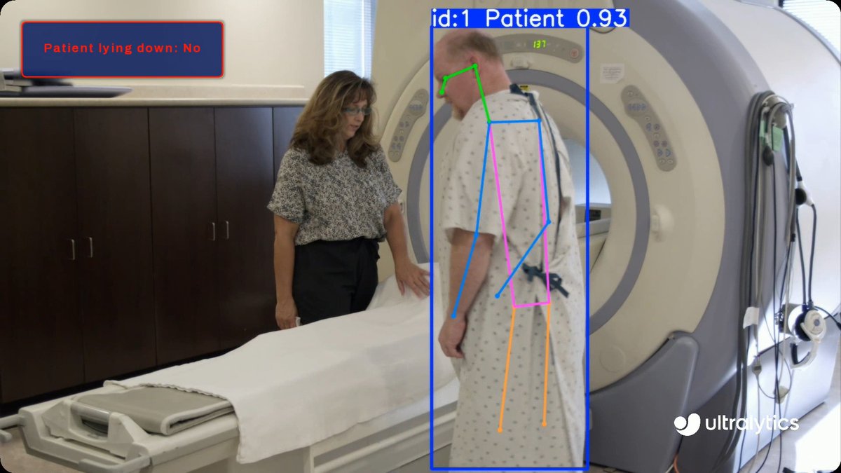 Monitor patient posture with Ultralytics YOLO26 Pose! Detect keypoints in real time to identify positions like lying down vs. standing. Useful for patient monitoring, fall-risk alerts, and hospital/elder-care room analytics. Learn more ➡️ #AI #PoseEstimation #HealthTech #YOLO26
