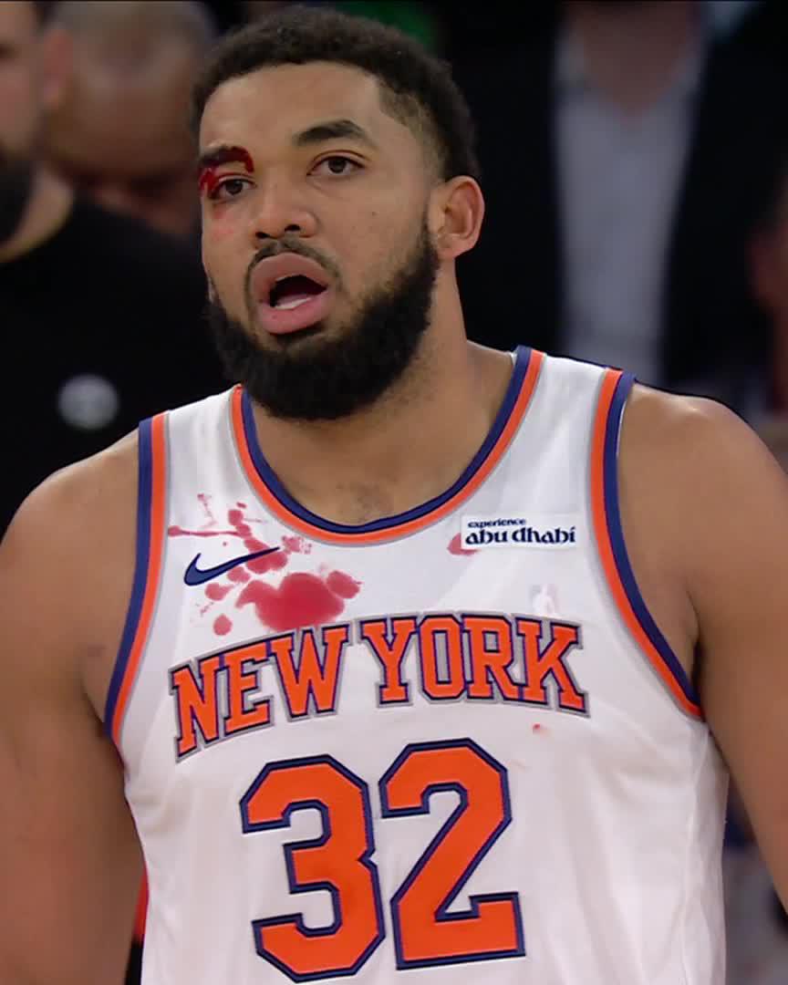 Karl-Anthony Towns was bleeding after colliding with Spencer Jones on this drive 😳