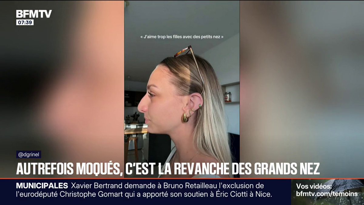 👃🇫🇷 Autrefois moqués, les grands nez sont de plus en plus populaires. (BFMTV)