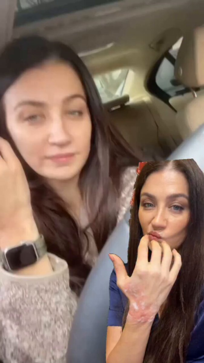 Eşref Rüya dizisinin Irmak’ı, sette önce eline kaynar mercimek çorbası döktü, ardından kopan ağaç dalı elini 2. kez yaraladı. “Kafayı yiyeceğim. Kimin gözü bu? Bana bakıp bu nazarı değdiren kimse, git öteye. Hiç tarzım da değil ya.. böyle nazar mı olur?”