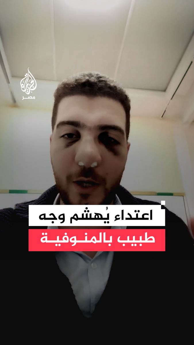 طبيب عظام يتعرض لاعتداء بمستشفى #الباجور بـ #المنوفية من صديق مرافق لإحدى الحالات ما سبب له كسرًا في الأنف وكدمات يالوجه ونقابة الأطباء تكلف مستشارها القانوني لمتابعة التحقيق