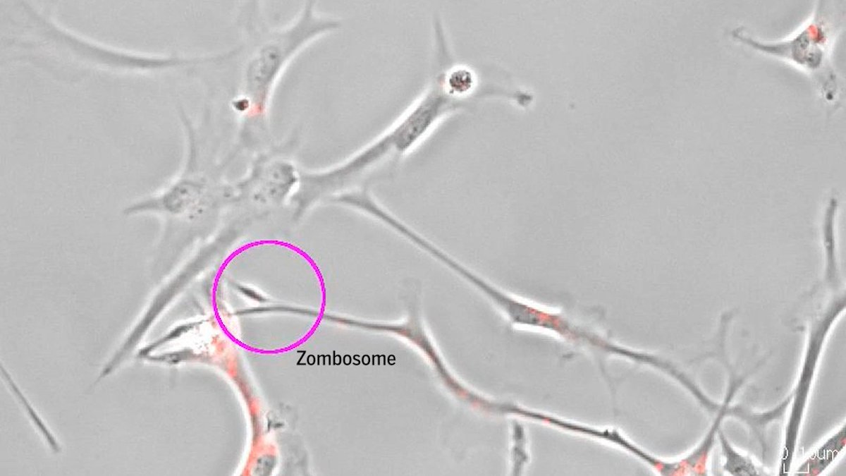 When key “housekeeper” brain cells grow in lab dishes, they spawn unusual microscopic vesicles that can move on their own and carry energy-generating organelles, a research team revealed. The biologists have dubbed their discovery zombosomes because the blobs can move like cells for a period despite lacking a nucleus, which acts as a cell's control center. The group also showed the membrane-bound messengers ferry proteins related to Parkinson’s disease, suggesting they may contribute to it and other brain disorders. Learn more: News from Science