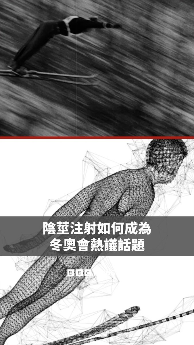 世界反禁药组织表示,若有证据显示男性跳台滑雪选手为提升竞技表现而对阴茎进行注射,该组织可能会介入调查。 此前有报导指出,跳台滑雪选手在进行比赛服尺寸测量前,会先在阴茎注射玻尿酸。玻尿酸目前在体育界并未被列为禁药,注射后可使阴茎周长增加一至两公分。 这将增加选手比赛服的表面积;根据国际滑雪总会(FIS)的说法,此举可能有助于增加选手的滞空表现。