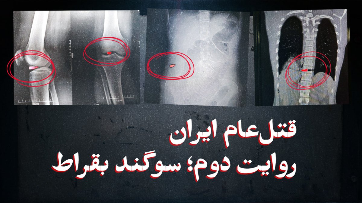 اینترنشنال (فکر کنم به اجبار توییتر) هی توییت فیلم مستند رو پاک میکنه. ویدئوی مستند از توییت منم پاک میشه. بازم اما میگذارمش. این ویدئو باید تو صفحهام باشه. ببینیدش. ⚠️حاوی تصاویر دلخراش(ی که باید در ذهن همگیمون باقی بمونه)