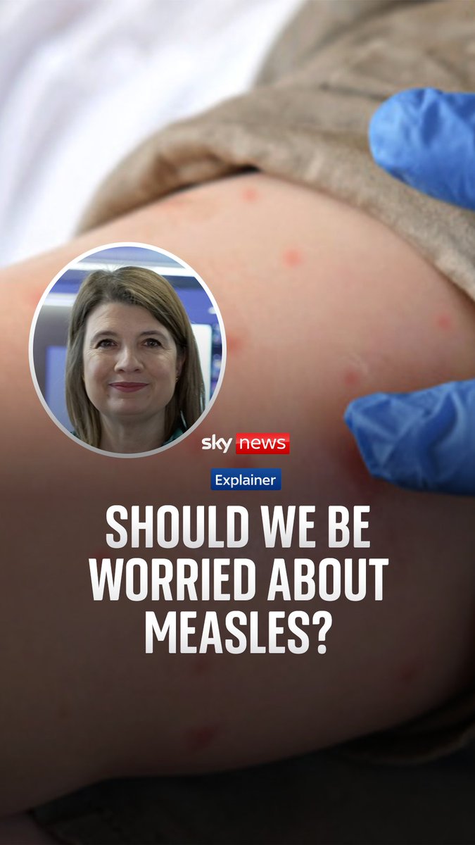 A measles outbreak has spread across several schools in north London, with some children needing hospital treatment. How serious is measles and how worried should we be? Sky's Laura Bundock explains