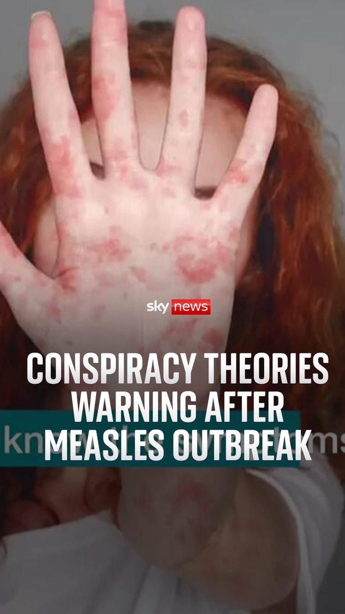 Sir Keir Starmer has warned "public health isn't a culture war" and urged parents to check their children are up to date with vaccinations. Sky's emma birchley reports on the recent measles outbreak.