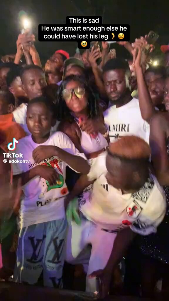 Ei Ghana police, Bro could have lost his leg if he had waited for a little longer