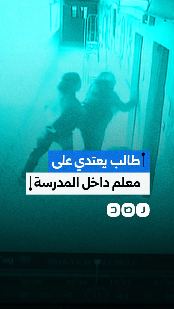 بسبب التقييم.. طالب يعتدي على معلمه داخل مدرسة السيدة عائشة تجريبي لغات ما أدى إلى كسر أنفه