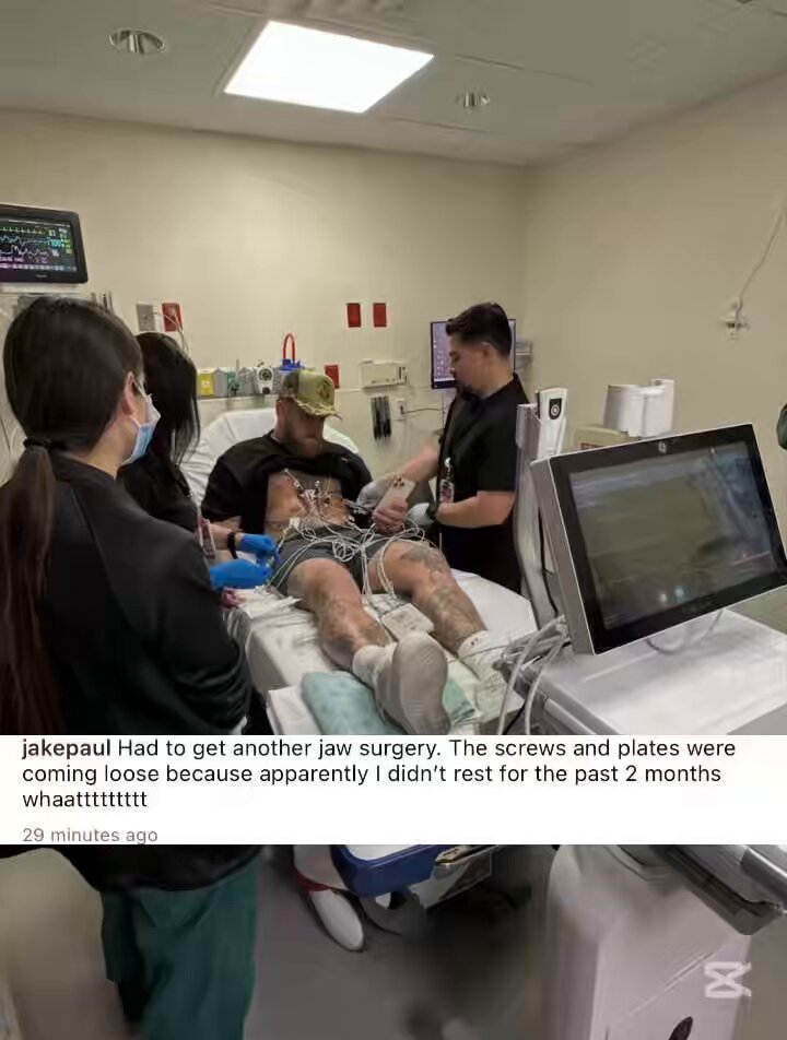 Jake Paul had to get another surgery. The plates and screws are loose. #BOXINGnBBQ #BOXING