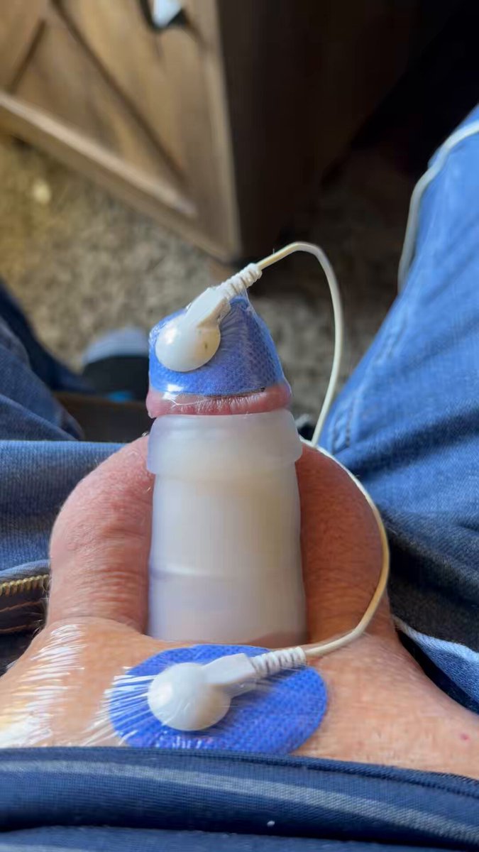120 min of shock therapy. I don’t know if it will make it grow harder or make it soft and impotent. It certainly makes it numb after a while. #tens #betaboi #pussyfree #cuck #uselessdicklette #sph #electrodes #shocktherapy #cbt #lilgurldick #boiclit #breakmydick