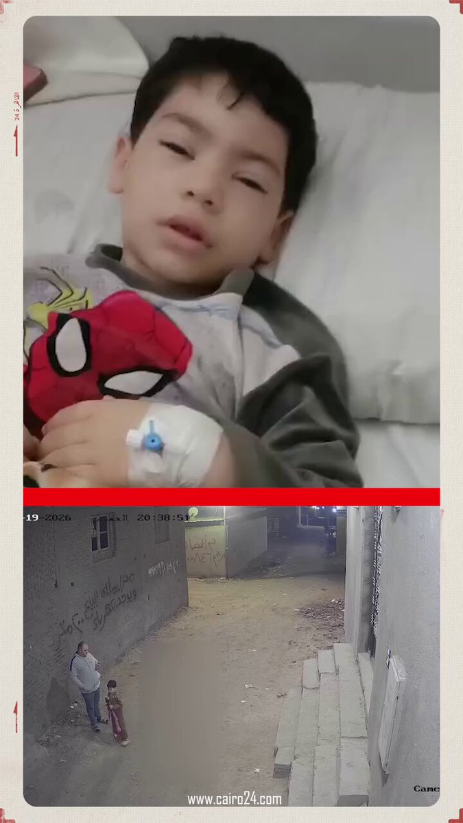 "لا حول ولا قوه الا بالله" .. - مينفعش نعدي اللي حصل ده!! مينفعش نسكت، مينفعش نتجاهل ان فيه اب كان خارج مع ابنه اللي عنده خمس سنين من المسجد، في اول رمضان، بعد صلاة التراويح، في قرية باسوس في القليوبية، وطلع عليه شاب ضرب الولد الصغير، الابن اللي عنده خمس سنين وهوا في حضن ابوه، بخرطوش، ودخول الولد المستشفى وبتر جزء من رجله اليمنى!! مينفعش نعدي المشهد ده!! سلامك النفسي على عيني وراسي بس "محمد احمد مرسي" احتمال يكمل حياته بطرف صناعي بسبب العيال دي، العيال دي خاصة اللي ضرب الخرطوش ده مينفعش يتجابوا بس، لازم يبقوا عبرة، لازم عشان لو مبقوش عبرة فيه قيم كتير اوي هتسقط، مشهد تجاوز في سوءه ما فعله العدو بمحمد الدرة في مطلع الالفينات!! ربنا معاك ويشفيك يا محمد يابني يارب .. BY: Mohamed Amir ✍️✍️✍️✍️ وزارة الداخلية
