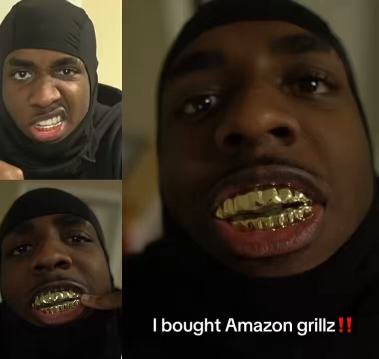 Man buys gold grillz on Amazon for $12.99, and this is how they turned out 👀