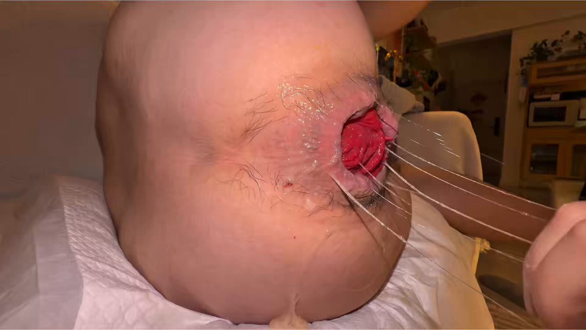 Do an anal examination for the Asian boy. It seems that he is ready.😈 男大爸爸互拳第一天后遗症👊🏻 屁股又肿又痒……里面还空空的只能央求狗儿子用拳头填满第二轮 今天继续深挖新视角，近距离观察被拳头进出破坏的肛门 #拳交 #fisting #fistfuck #analfisting #NSFW #gayfist #重口味 #拳交视频