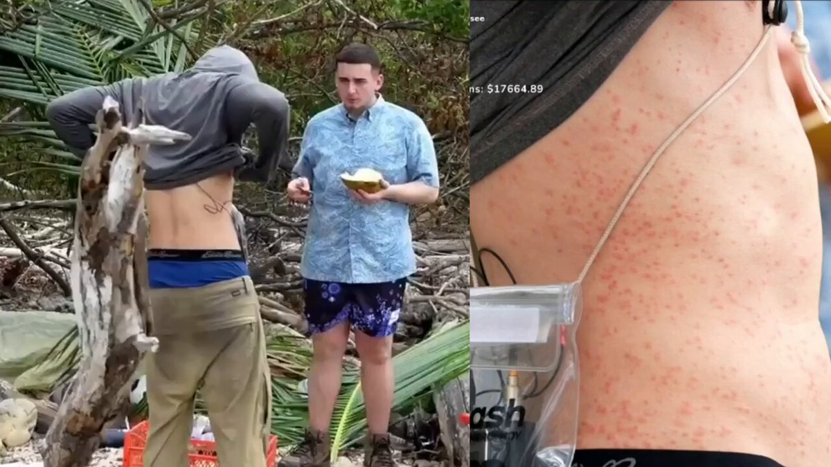 Lacy was shocked after seeing how different JasonTheWeen’s body looks after getting bitten by sand fleas and losing weight during his 7-day “Stranded” stream 😳