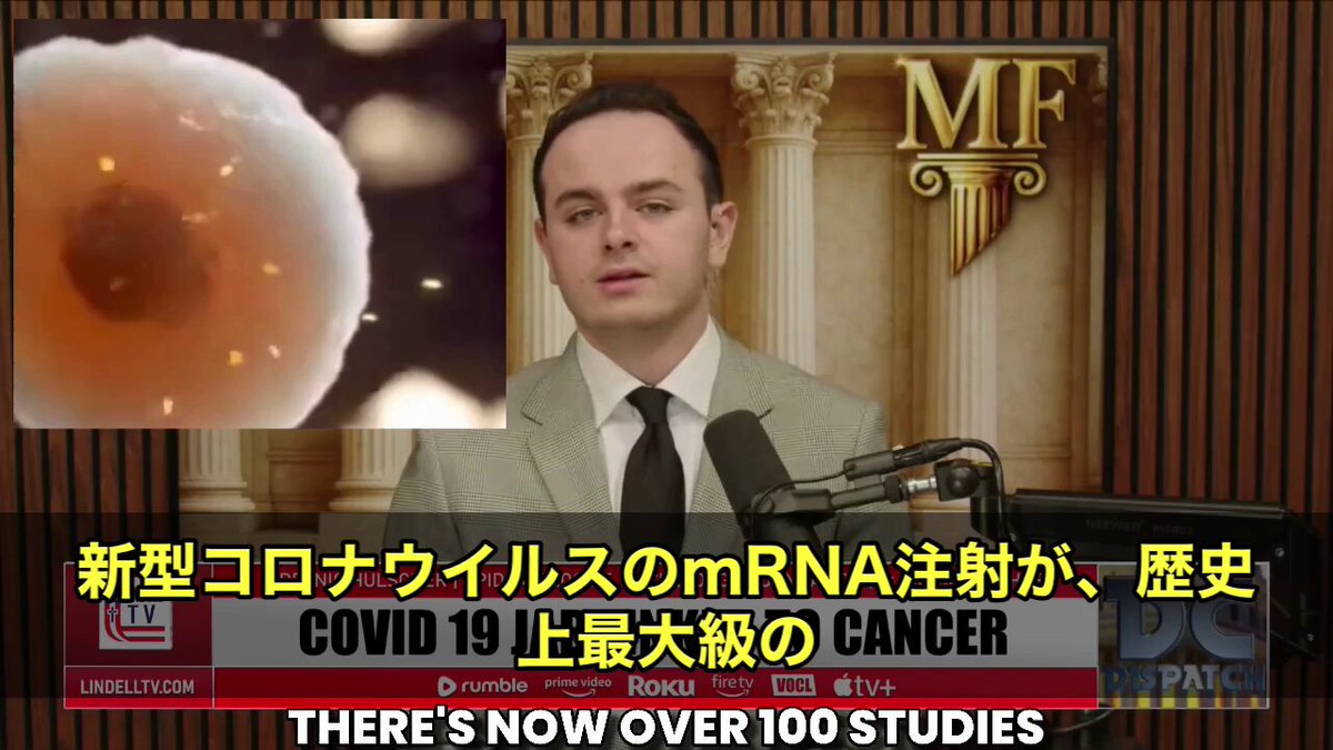 まさかと思っていたはずの話が、ここにきて一気に積み上がってきています。 今、世界中で 数百件の研究 が並び始めていて、例のCOVIDワクチンが…. 歴史上でも最大級の 発がん性エクスポージャー として扱われ始めているんです。 まず、動画内で語られていたのは 「接種後の体調変化が説明できないまま続いている人が増えている」 という現場の違和感。 そして出てきたのが、この研究一覧なんですね。 どうやら、専門家たちが問題視しているのは単なる免疫低下とか、そういう話じゃないようです。 例えば…. 💉 7つの主要ながんリスクが上昇する 💉 ワクチン成分が人のゲノムに入り込む可能性 💉 数千の重要遺伝子が乱れる 💉 DNA修復そのものが抑制される 💉 腫瘍の免疫逃避を助ける挙動が確認される 💉 休眠していたがんが再活性化するケース 💉 T細胞が弱まり、免疫の司令塔IFNも低下 💉 がん化を促す主要経路（MAPK、AKTなど）が活性化 💉 SV40配列を含むプラスミドDNAの混入問題 💉 IgG4への異常な免疫シフト 💉 腫瘍微小環境の改変、炎症の慢性化 そして、専門家がざっと並べただけで20項目。 しかも、どれもがん研究では“核心”と言われてきた領域なんですよね。 こうした報告が重なってくると、 動画でも話されていたように 「接種後に説明のつかない変化が体の深部で起きているのでは」 という視点が、単なる疑問では済まなくなってきます。 一体、どこまで明らかになるのか。 そして、何が起きているのか。 専門家たちはいま、加速度的にデータを積み上げ続けています。