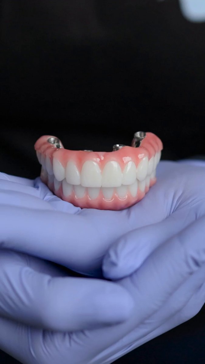 Traditional dental implants can take 10+ months, Nuvia delivers Permanent Teeth in 24hours.