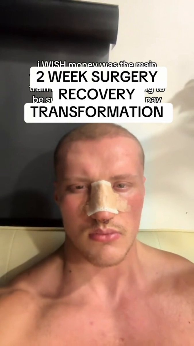 #2 ranked CHAD Androgenic has FULLY RECOVERED from his surgery and will be FLYING OUT to Miami THIS WEEKEND to FRAME MOG the ASU FRAT LEADER 👀