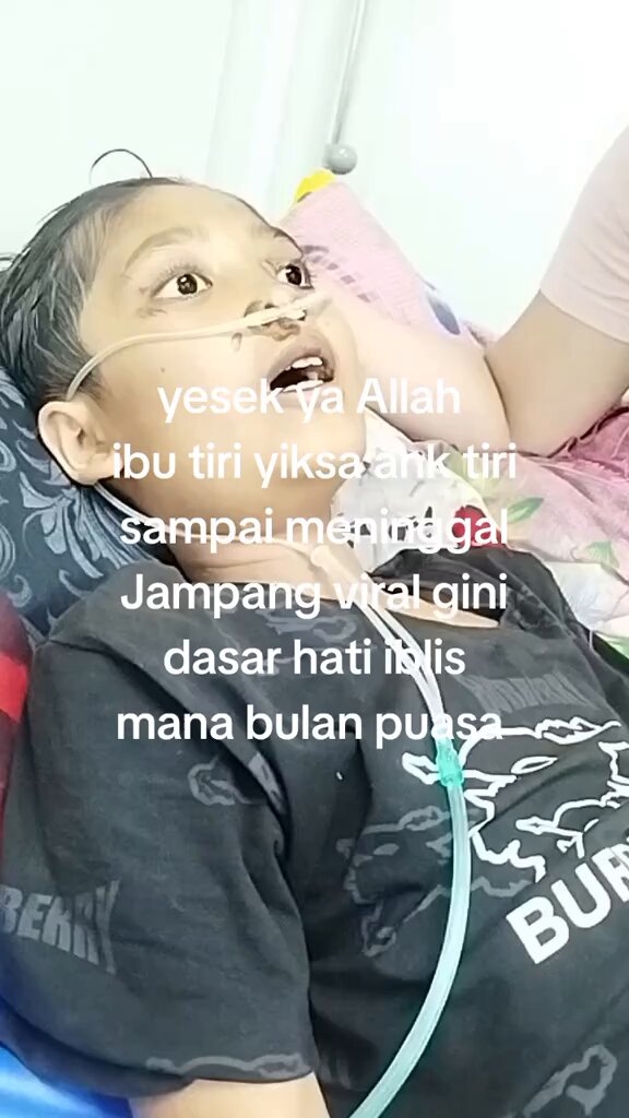 Luka dibawah belum termasuk soal informasi dari anak yg dipaksa minum air panas. Kalo ada yg sebut iblis itu wajar. Ditemukan luka bakar di lengan, kaki, punggung, hingga area bibir dan hidung, dan paru-parunya sedikit membengkak.