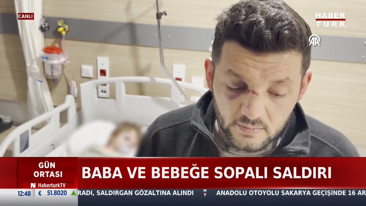 Baba ve bebeğe sopalı saldırı Yalova’da bir apartmanda yaşanan yüksek ses tartışması, 14 aylık bir bebeğin ağır yaralandığı korkunç bir saldırıya dönüştü.