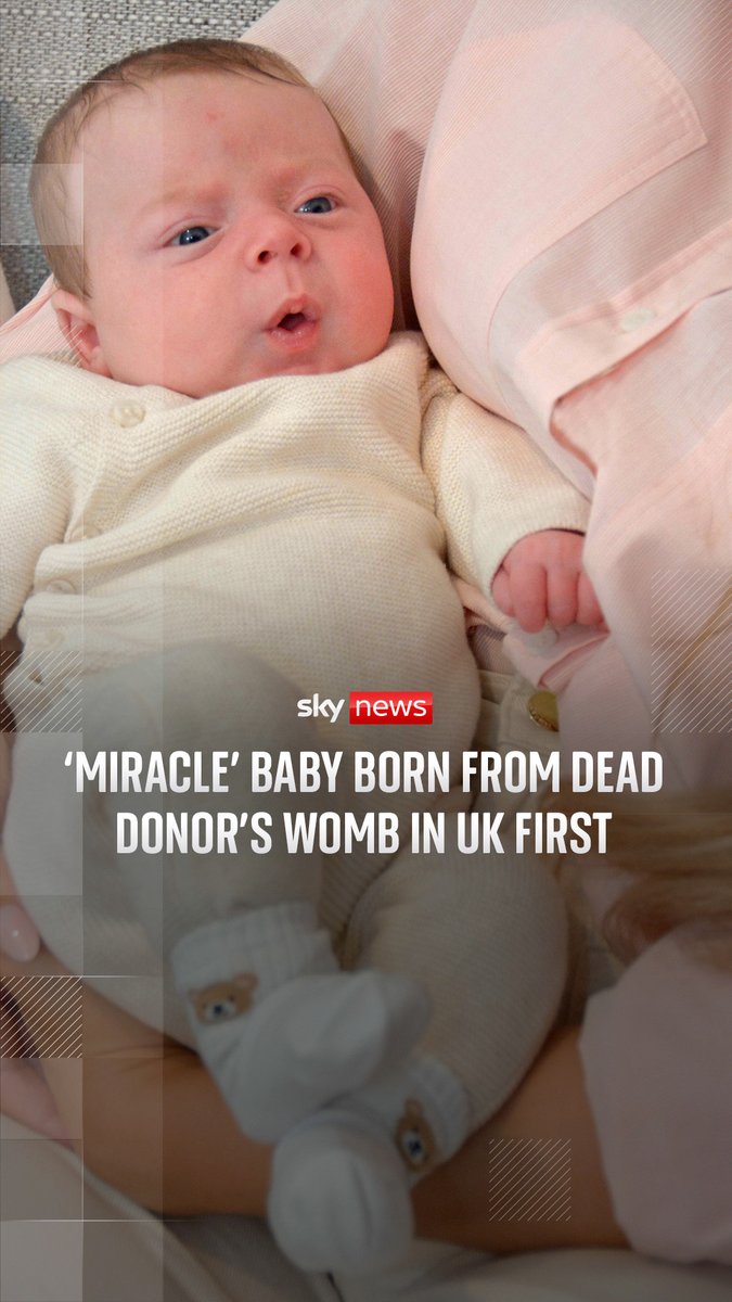 Hugo Powell is the first child in the UK to be born to a mother via a womb transplanted from a deceased donor. His parents Grace and Steve have described his arrival as a 'miracle'. Only two other babies have been born in this way. 🔗
