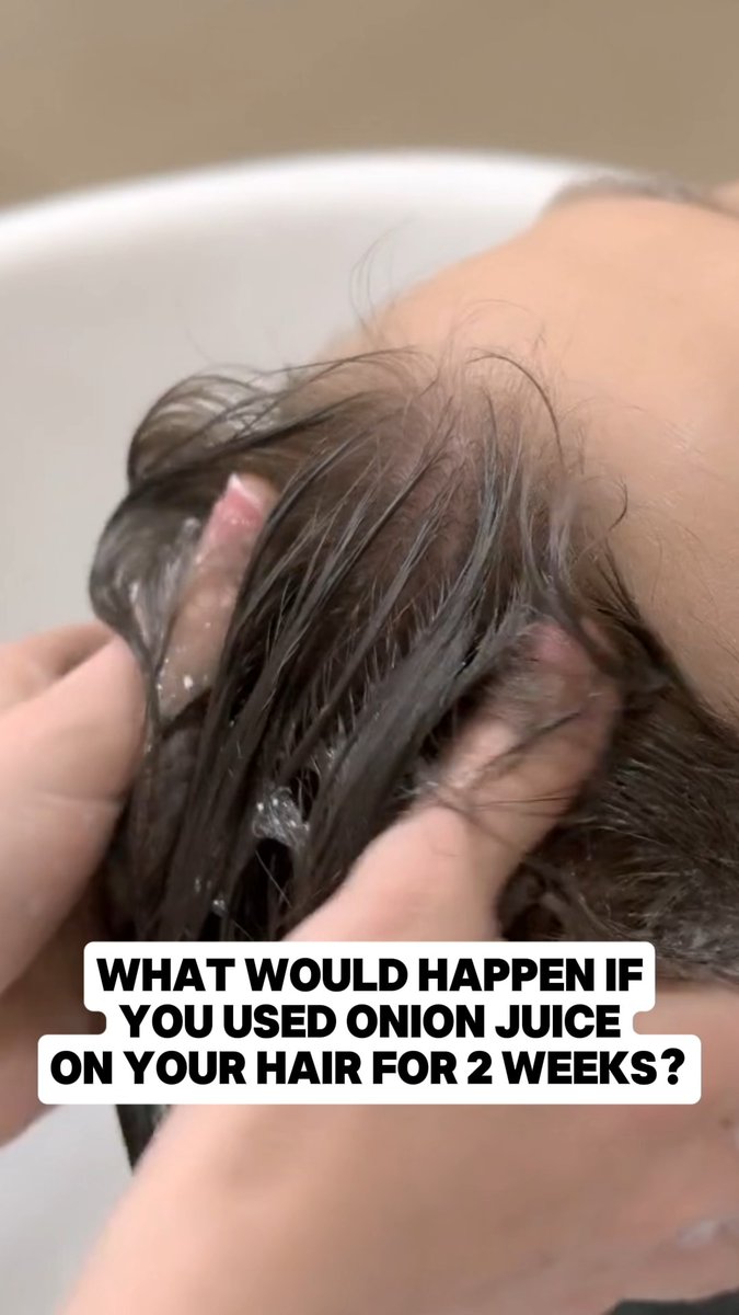 This is what would happen if you used onion juice on your hair for 2 weeks!